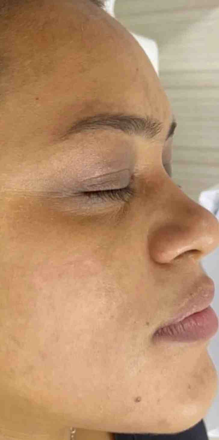Después de 5 semanas